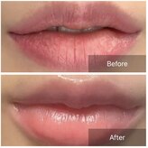 ホワイトニングサロンブライト 新宿店(Whitening salon bright)