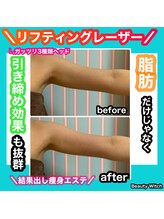 ビューティ ウィッチ(Beauty Witch)/