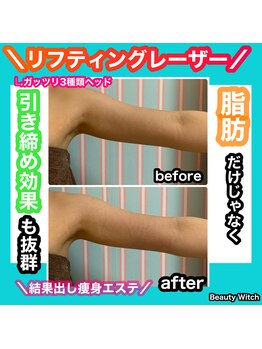 ビューティ ウィッチ(Beauty Witch)/