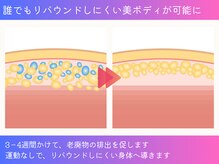 ボディーリセット 勝どき/≪脂肪冷却/勝ちどき≫