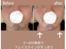 メディボーテサロン(MEDI BEAUTE SALON)/世界初の機器を使用しています