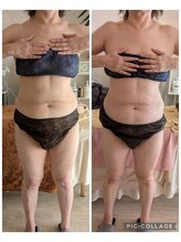 ムーンブロッサム(MoonBlossom)/脂肪燃焼150分全身ボディー