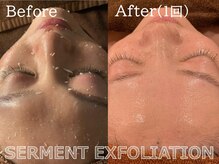 ココモンド(COCOMONDO)/セルマン艶肌ピーリング