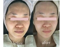 トリートメントルーム フェリーチェ(Felice)/黄ぐすみ卒業！血色まとう透明肌