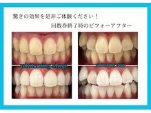 ホワイトニング ショップ 豊見城店