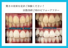 ホワイトニング ショップ 豊見城店