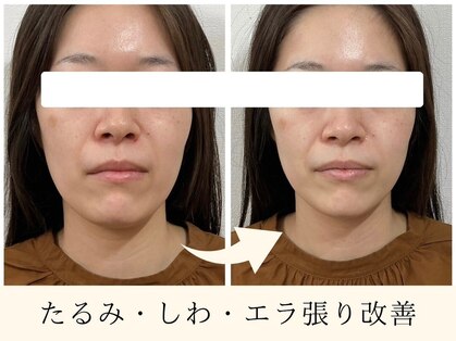 ブランソワンの写真
