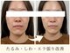 ブランソワンの写真