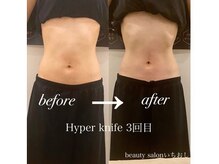 リ ラフ(Re laugh)/お客さの声