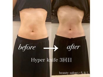 リ ラフ(Re laugh)/お客さの声