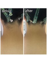 パーソナルエステティックサロン リボーン(ReBorn)/