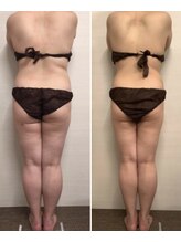 ジュメル 恵比寿店(Jumelles)/キレイな後ろ姿を(*^^*)