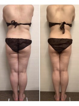 ジュメル 恵比寿店(Jumelles)/キレイな後ろ姿を(*^^*)