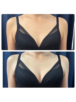 ラサン(Rasun)/お下着アドバイス