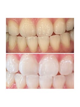 シャイニー 仙台駅東口(SHINY)/お客様の変化