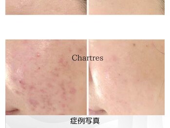 シャルトルズ 西宮北口店/