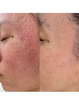 セリジェ 青山の写真/[プロセルセラピーズ]今までの美容施術でも難しい深いお悩みも驚きのスピードで改善◎多様なお悩みに対応！