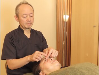 モカ(MOKA)の写真/国家資格者が施す本格美容鍼で年齢肌と小顔、たるみ悩みに徹底対応