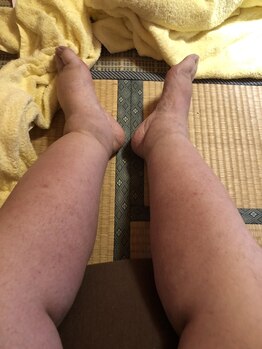 リデザイン 京都(REDESIGN)/REDESIGN京都中医施術法