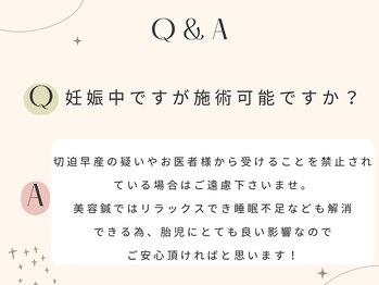 ビープラス(BEE PLUS)/Q&A