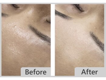 エマクラン(emmaclan)/