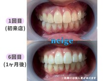 ネージュ(neige)/20代後半/女性/ 紅茶たまに 