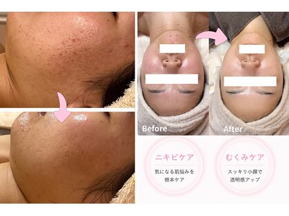 ビューティーリアライズ(Beauty Realize)の写真