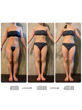 ボーレーヴ 表参道店(beaureve)/施術効果写真（before after）