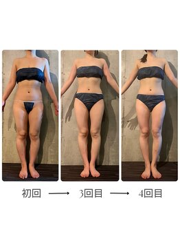 ボーレーヴ 表参道店(beaureve)/施術効果写真(before after)