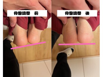 ボディステップ(BODY STEP)/骨盤調整