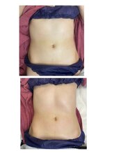 ルルン(LuLuN)/お腹スッキリしたい方！