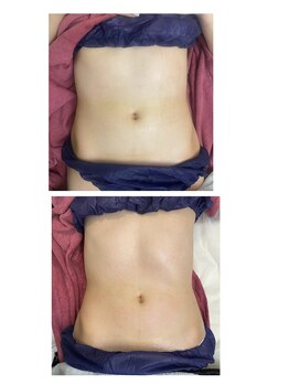 ルルン(LuLuN)/お腹スッキリしたい方！