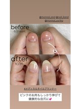 リアンド(Li&)/【深爪・トラブル爪】美爪育成