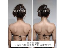 エクラリュクス アオヤマ(eclat Luxe AOYAMA)の雰囲気（1度の施術で肩甲骨が出現。2回目から更なる効果で華奢みえに♪）