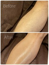 ニコプラス(NICO+)/