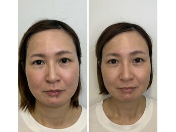 ドクターボディクリスタル(Dr.Body Crystal)/40代