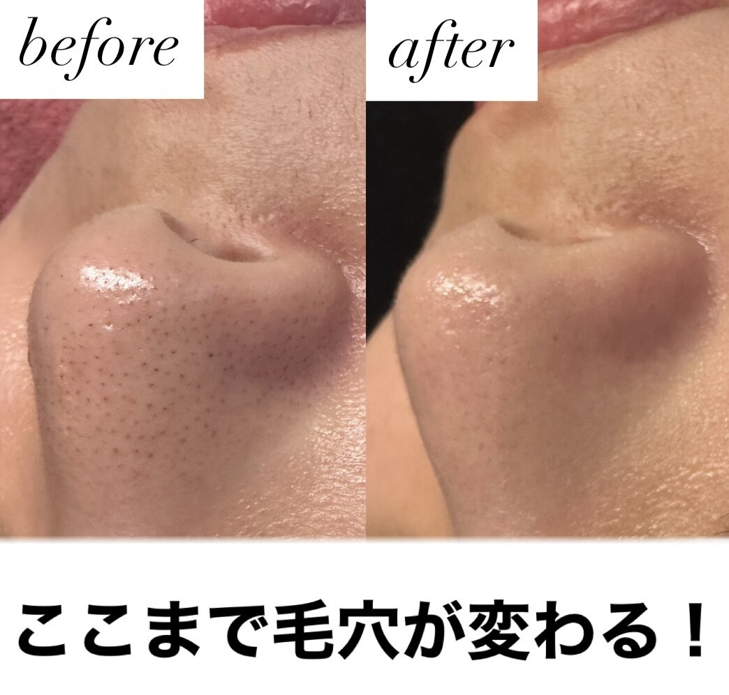 ブルーシー(BLUESEA)｜ホットペッパービューティー