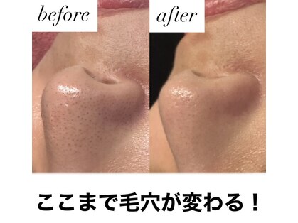 ブルーシー(BLUESEA)の写真