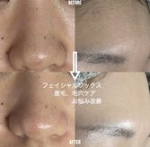 アレーズファイブフォー(A’LAISE54)