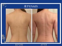 ビテュセスリー はなみずき店(美tusais3)/【美人バスト松山】バストアップ