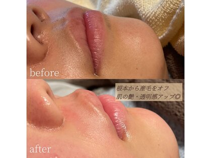 コモレビ(komorebi)の写真