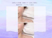 サロン タエン/艶肌＆小顔！オイルフェイシャル