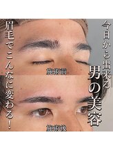 ノル(NOLU)/先ずはご相談下さい○