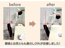 フィクシブ 上野(FIXIBE)/腰が反れるように！