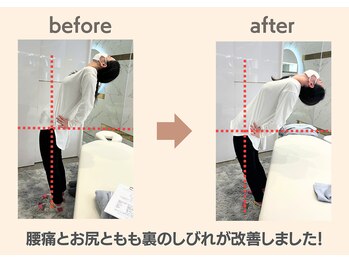 フィクシブ 上野(FIXIBE)/腰が反れるように！