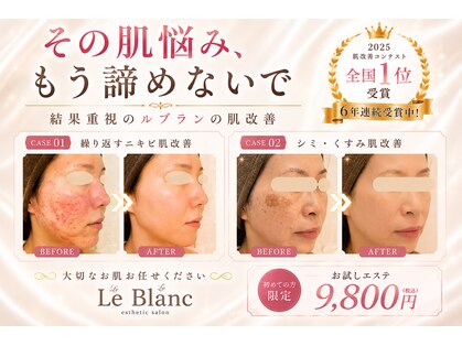 ルブラン(Le Blanc)の写真