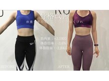 ビヨンド 札幌大通店(BEYOND)/女性 -3.6%のビフォーアフター