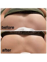 コティーバイホイヤ(Cotty by HOIYA)/バストアップケア