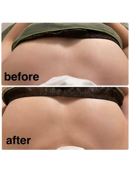 コティーバイホイヤ(Cotty by HOIYA)/バストアップケア