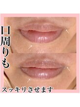 エクラーレ(Eclale)/マリムーブフェイシャルワックス